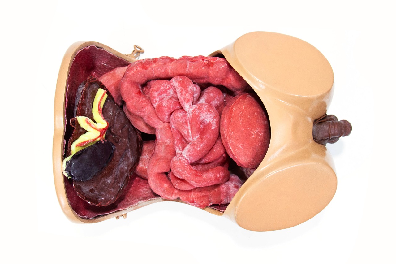 Laparoscopic surgical simulation model